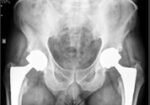 Orthopaedic & Joint Replacement Service